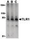 Toll Like Receptor 1 antibody, LS-B600, Lifespan Biosciences, Western Blot image 