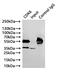 Cyclin Dependent Kinase 6 antibody, CSB-RA555745A0HU, Cusabio, Immunoprecipitation image 