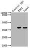 Cyclin Dependent Kinase 6 antibody, CSB-RA555745A0HU, Cusabio, Immunoprecipitation image 