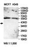 Mitochondrial-processing peptidase subunit alpha antibody, orb78388, Biorbyt, Western Blot image 
