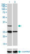 Steroidogenic Acute Regulatory Protein antibody, LS-C198275, Lifespan Biosciences, Western Blot image 