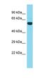 Ankyrin Repeat Domain 55 antibody, orb326806, Biorbyt, Western Blot image 