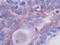 Platelet Derived Growth Factor Subunit A antibody, PP1061P1, Origene, Immunohistochemistry paraffin image 