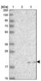 Mitochondrial Ribosomal Protein L22 antibody, NBP2-30482, Novus Biologicals, Western Blot image 