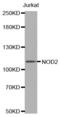 Nucleotide Binding Oligomerization Domain Containing 2 antibody, abx001188, Abbexa, Western Blot image 