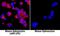 Triggering Receptor Expressed On Myeloid Cells 1 antibody, BAM1187, R&D Systems, Immunocytochemistry image 