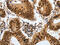 COP9 Signalosome Subunit 5 antibody, CSB-PA781273, Cusabio, Immunohistochemistry paraffin image 