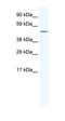 RELB Proto-Oncogene, NF-KB Subunit antibody, orb329942, Biorbyt, Western Blot image 