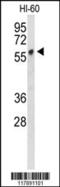 Plasmalemma Vesicle Associated Protein antibody, 63-917, ProSci, Western Blot image 