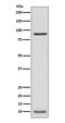 NEDD8 Ubiquitin Like Modifier antibody, M00547, Boster Biological Technology, Western Blot image 