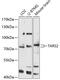 Threonyl-TRNA Synthetase 2, Mitochondrial antibody, 14-664, ProSci, Western Blot image 