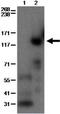 Phosphodiesterase 3B antibody, 14-1973-82, Invitrogen Antibodies, Western Blot image 