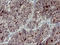 Matrix Metallopeptidase 13 antibody, LS-C797730, Lifespan Biosciences, Immunohistochemistry frozen image 