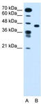 Solute Carrier Family 35 Member C1 antibody, TA333752, Origene, Western Blot image 