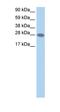 Transcription Elongation Factor A2 antibody, orb324474, Biorbyt, Western Blot image 