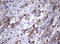 TNKS antibody, LS-C175660, Lifespan Biosciences, Immunohistochemistry frozen image 