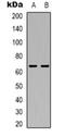 Thyroid Hormone Receptor Interactor 4 antibody, orb318943, Biorbyt, Western Blot image 