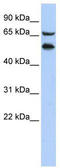 Transcriptional Adaptor 2A antibody, TA335197, Origene, Western Blot image 