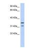 Elongator Acetyltransferase Complex Subunit 5 antibody, NBP1-57696, Novus Biologicals, Western Blot image 