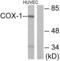Prostaglandin-Endoperoxide Synthase 1 antibody, LS-B7596, Lifespan Biosciences, Western Blot image 