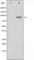 Spleen Associated Tyrosine Kinase antibody, abx011583, Abbexa, Western Blot image 