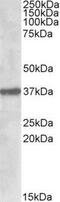 Sulfatase Modifying Factor 1 antibody, NBP1-45212, Novus Biologicals, Western Blot image 