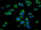 Acetyl-CoA Acetyltransferase 2 antibody, GTX84971, GeneTex, Immunofluorescence image 