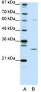 Mediator Complex Subunit 7 antibody, TA334248, Origene, Western Blot image 
