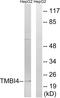 Transmembrane BAX Inhibitor Motif Containing 4 antibody, A09304, Boster Biological Technology, Western Blot image 