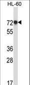 RNA Binding Motif Protein 39 antibody, LS-C162498, Lifespan Biosciences, Western Blot image 