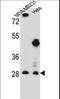 Eukaryotic Translation Initiation Factor 4H antibody, LS-C167712, Lifespan Biosciences, Western Blot image 