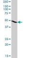 Actin Related Protein 3B antibody, H00057180-B01P, Novus Biologicals, Western Blot image 