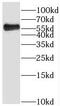 Serum/Glucocorticoid Regulated Kinase Family Member 3 antibody, FNab07808, FineTest, Western Blot image 