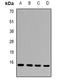 Cytosolic Iron-Sulfur Assembly Component 2B antibody, orb341362, Biorbyt, Western Blot image 