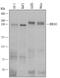 BRCA1 DNA Repair Associated antibody, MAB22101, R&D Systems, Western Blot image 