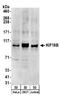 Kinesin Family Member 18B antibody, A303-982A, Bethyl Labs, Western Blot image 