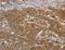 CFL1 antibody, LS-C404829, Lifespan Biosciences, Immunohistochemistry frozen image 