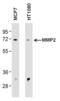 Matrix Metallopeptidase 2 antibody, MA1-772, Invitrogen Antibodies, Western Blot image 