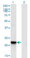 Regulator Of G Protein Signaling 5 antibody, LS-C198574, Lifespan Biosciences, Western Blot image 