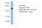 Keratin 12 antibody, A05227, Boster Biological Technology, Western Blot image 