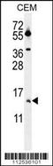 Matrix Gla Protein antibody, MBS9210581, MyBioSource, Western Blot image 