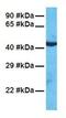 WW Domain Containing Transcription Regulator 1 antibody, GTX77881, GeneTex, Western Blot image 