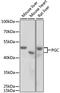 Progastricsin antibody, MBS127732, MyBioSource, Western Blot image 