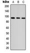 Ankyrin Repeat Domain 20 Family Member A1 antibody, GTX56043, GeneTex, Western Blot image 