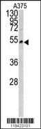 Lumican antibody, MBS9201473, MyBioSource, Western Blot image 