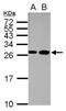 Myosin Light Chain 1 antibody, NBP2-16433, Novus Biologicals, Western Blot image 