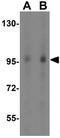 Transportin 3 antibody, GTX31344, GeneTex, Western Blot image 