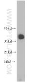 Pyruvate Dehydrogenase E1 Beta Subunit antibody, 14744-1-AP, Proteintech Group, Western Blot image 
