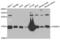 Cellular Retinoic Acid Binding Protein 2 antibody, abx004683, Abbexa, Western Blot image 