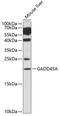 Growth Arrest And DNA Damage Inducible Alpha antibody, GTX54090, GeneTex, Western Blot image 